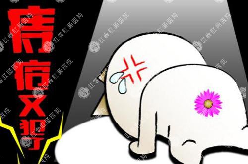 泉州治疗混合痔价格贵不贵
